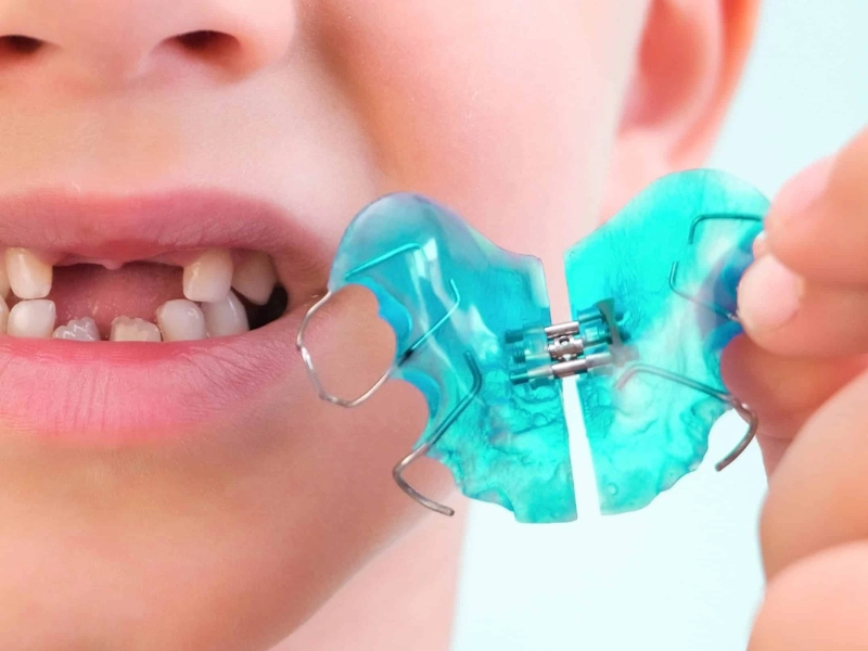 Atendimento odontopediátrico e ortopedia funcional